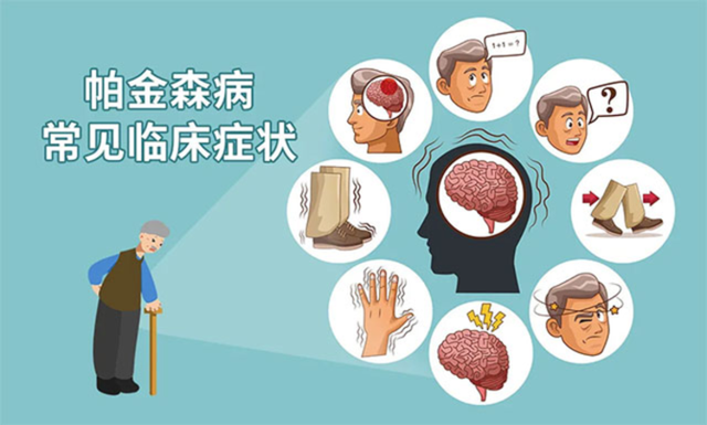 帕金森病的非运动症状,可能会在其运动症状出现的数年甚至数十年前