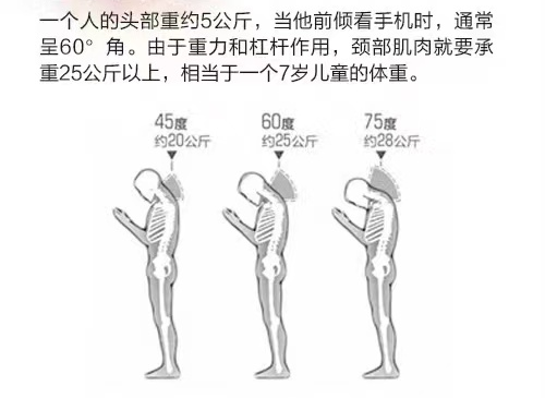 2023.11.30安全提示｜你也是这样低头走路吗？4.png