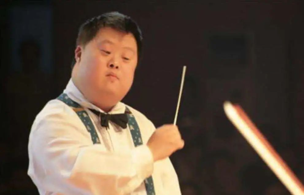 曾经名噪一时的唐氏患儿-"天才指挥家"舟舟特殊面容患儿眼距宽,鼻梁低