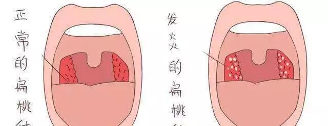 关注 女歌手癌症晚期 300天后肿瘤消失 她经历了什么